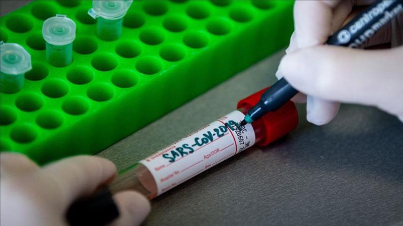 Araştırmacılar, Koronavirüs Belirtilerini 6 Kümeye Ayırdı