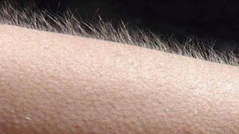 Tüylerimizin Neden Soğuktan Korumadığı Halde Diken Diken Olduğu Ortaya Çıktı