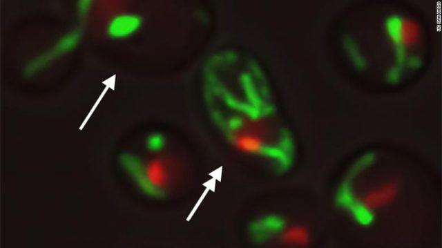 Bilim İnsanları, Yaşam Süresini Uzatmayı Mümkün Kılacak Bir Keşifte Bulundu