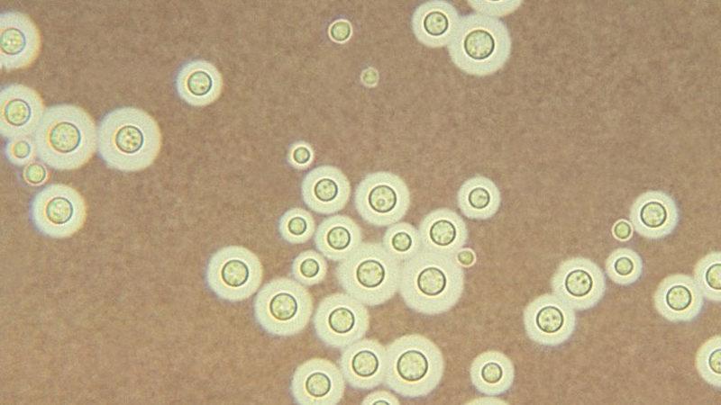 Astronotları Kozmik Işınlardan Koruyacak Şey Çernobil’deki Mantarlar Olabilir