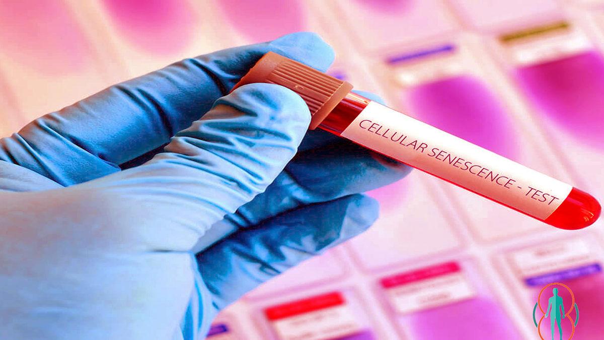 Siyanür Nedir, Nerelerde Kullanılır ve Siyanür Zehirlenmesinin Belirtileri Nelerdir?