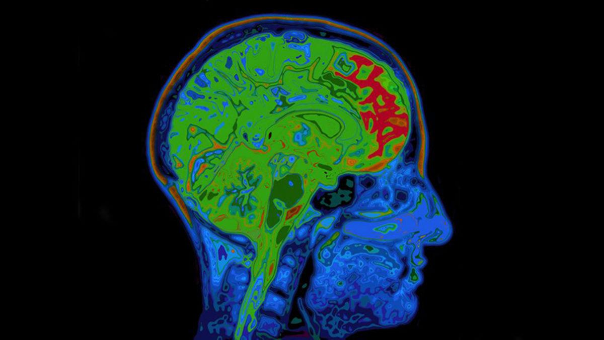 Beynimiz Çalışırken Ne Kadar Enerji Harcıyor?