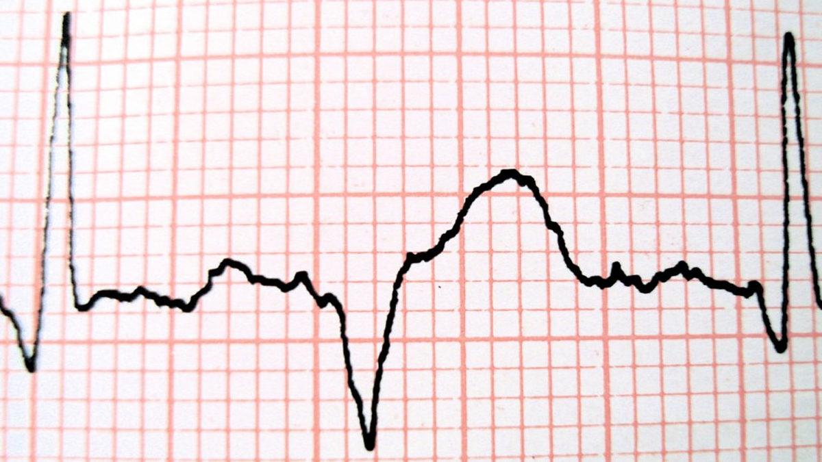 Türk Bilim İnsanı, Vücuttaki Kimyasal Stresi Ölçen Yerli Kit Geliştirdi