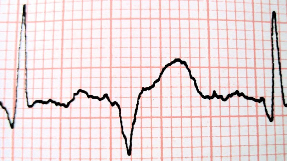 Türk Bilim İnsanı, Vücuttaki Kimyasal Stresi Ölçen Yerli Kit Geliştirdi