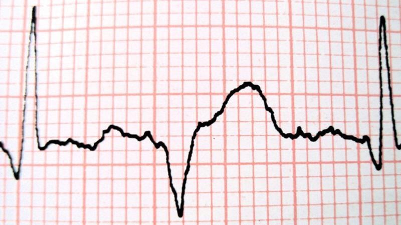 Türk Bilim İnsanı, Vücuttaki Kimyasal Stresi Ölçen Yerli Kit Geliştirdi