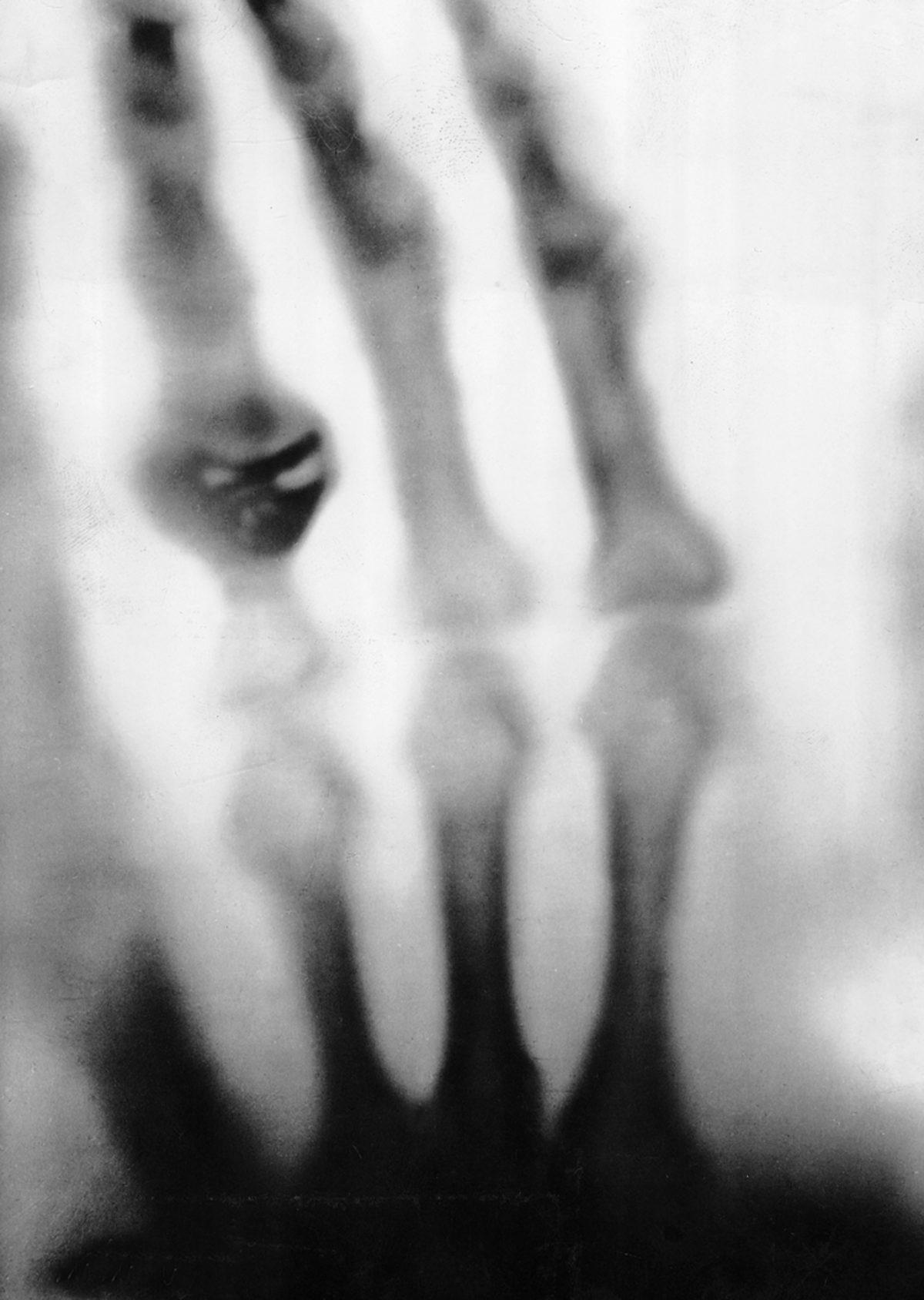 124 Yıl Önce Çekilen İlk Röntgen Filmindeki İlginç Detay