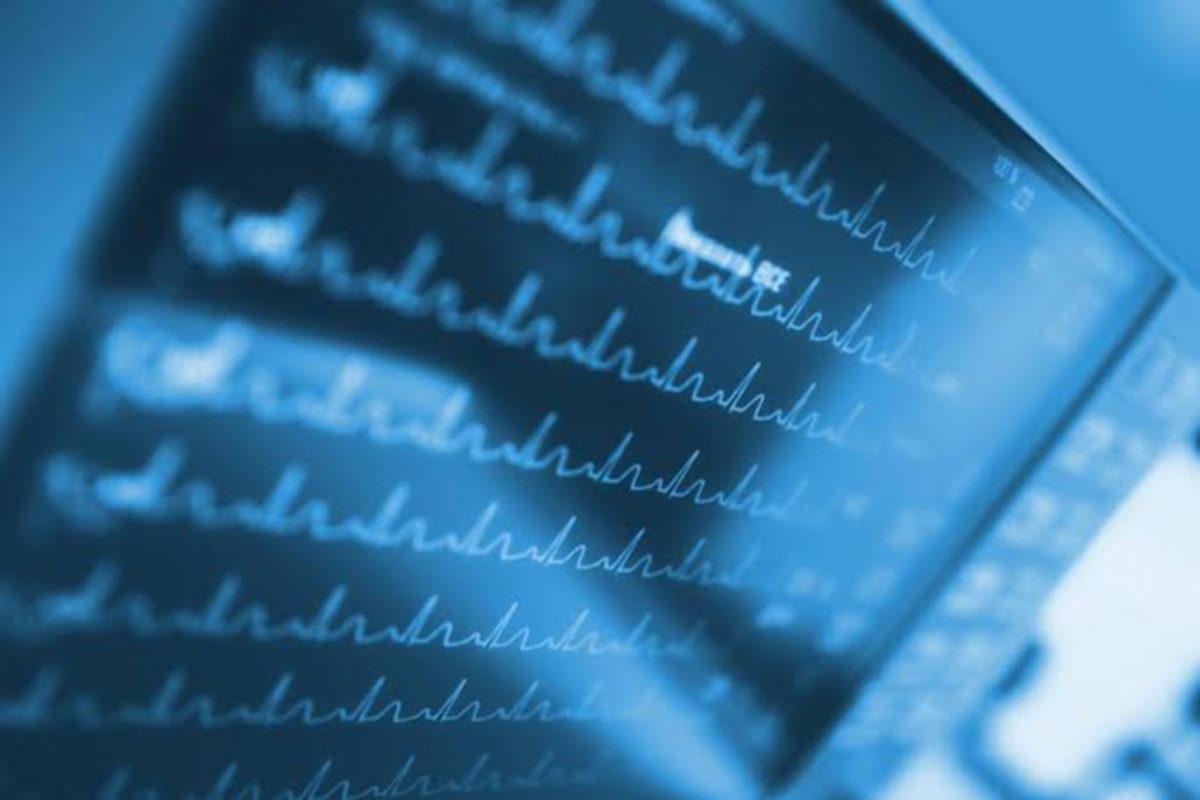 Yapay Zeka, Bir Yıl İçinde Hayatını Kaybedecek İnsanları Tespit Etti