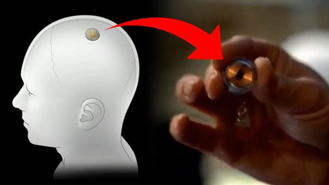 Elon Musk, İnsan Beynini Bilgisayarlara Bağlayan İlk Ticari Cihaz Neuralink’i Tanıttı