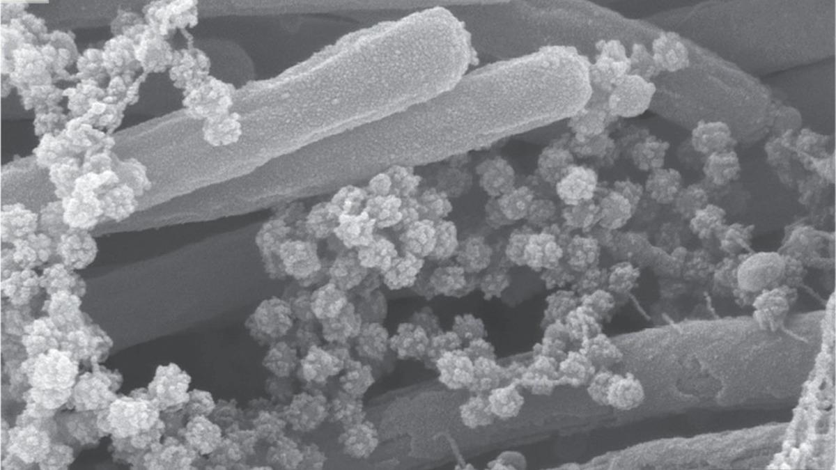 Koronavirüsün Akciğerlerimizi Nasıl ‘Sardığını’ Gösteren Yeni Görüntü