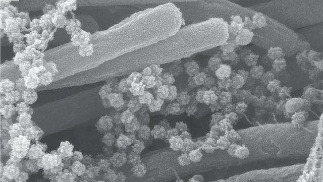 Koronavirüsün Akciğerlerimizi Nasıl ‘Sardığını’ Gösteren Yeni Görüntü