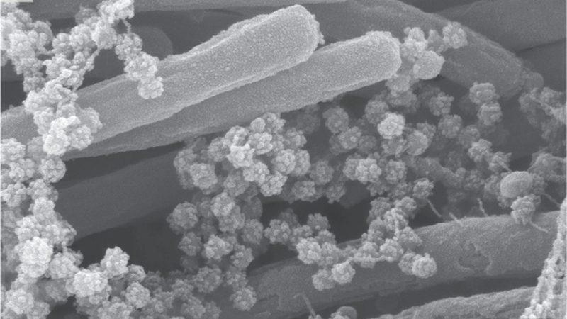 Koronavirüsün Akciğerlerimizi Nasıl ‘Sardığını’ Gösteren Yeni Görüntü