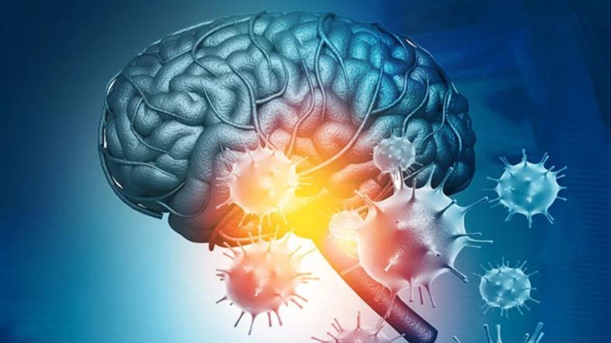 Koronavirüsün Beyni Nasıl ’Öldürdüğü’ Ortaya Çıktı