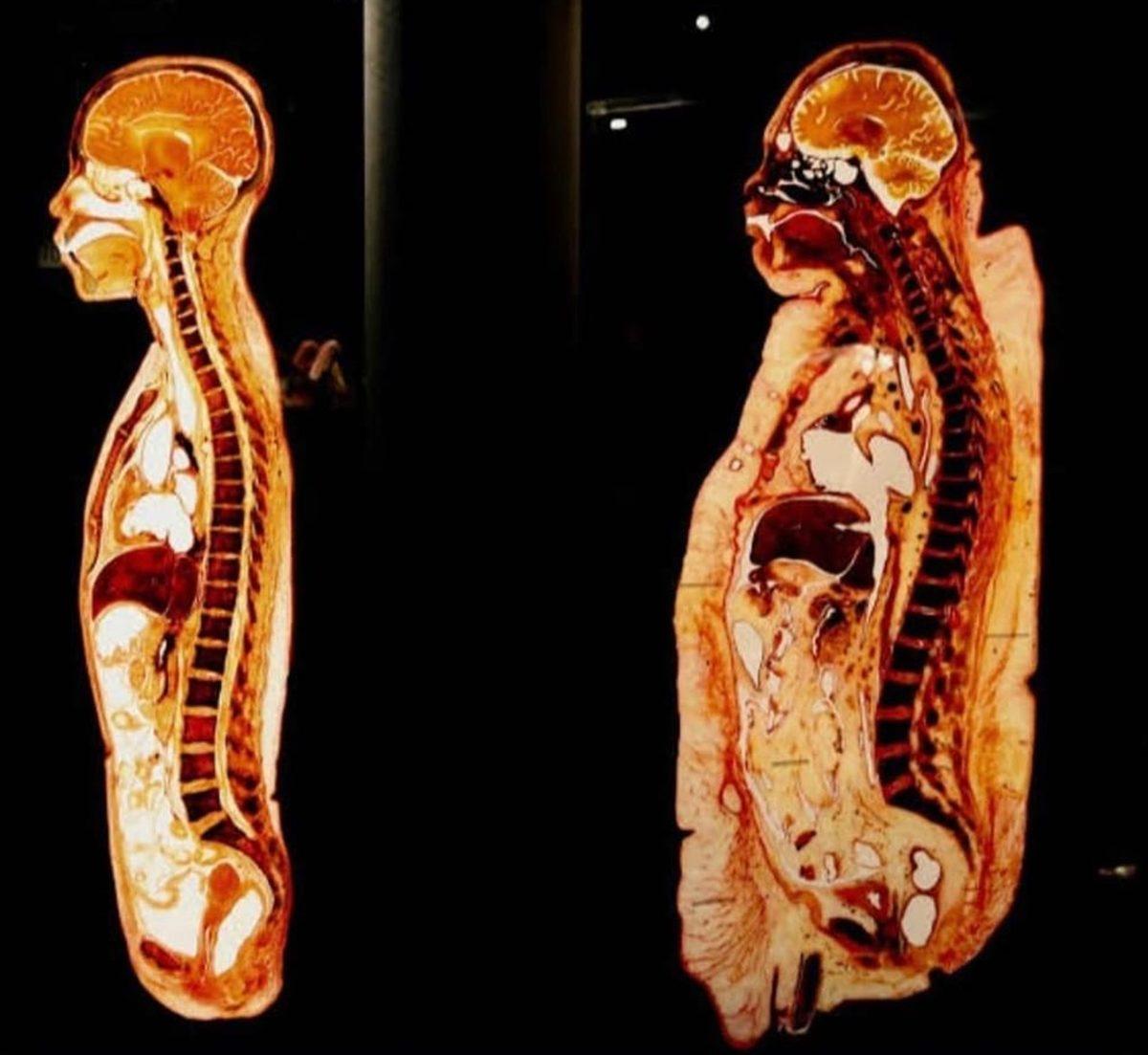 Gördüğünüz An Bir Süre Donup Kalmanıza Neden Olacak 25 Sıra Dışı Görüntü