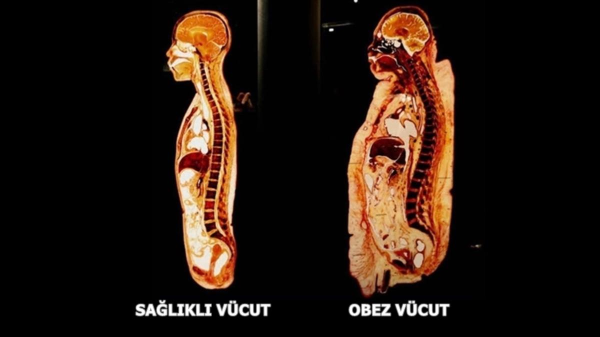 Gördüğünüz An Bir Süre Donup Kalmanıza Neden Olacak 25 Sıra Dışı Görüntü