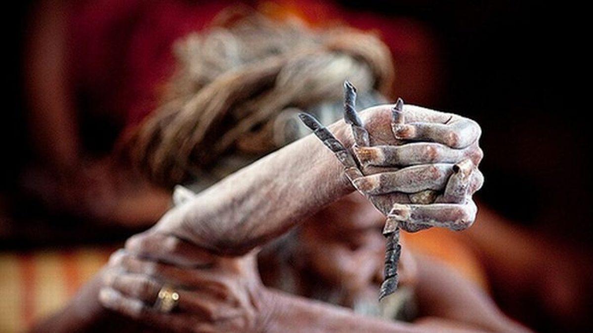 Tamam da Neden? 48 Yıldır Sağ Kolunu Havada Tutan Adamın Hayatı Sorgulatan Hikayesi