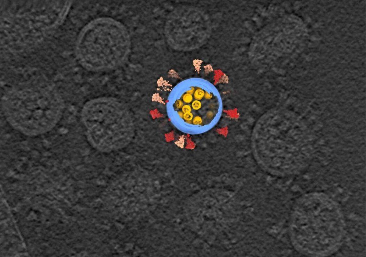 Covid-19’un İnsan Hücresinde Girdiği An Net Bir Şekilde Görüntülendi