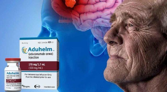 Onay Alması ABD’de Kriz Yaratmıştı: Tartışmalı Alzheimer İlacı, Avrupa’dan Onay Alamadı