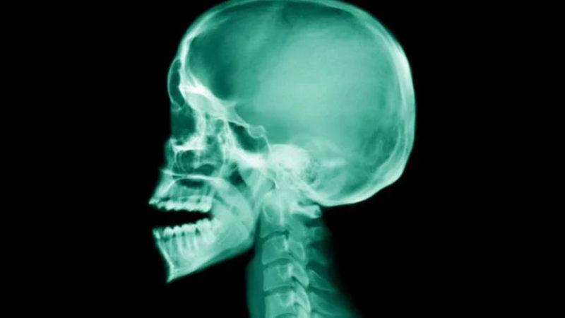 Bilim Yine Şaşırttı: İnsan Çenesinde Yeni Bir Kas Tabakası Keşfedildi