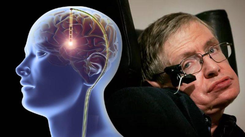 Felçli Bir Birey, Beynine Yerleştirilen Bir Cihaz Sayesinde ’Sadece Düşünerek’ Tweet Attı