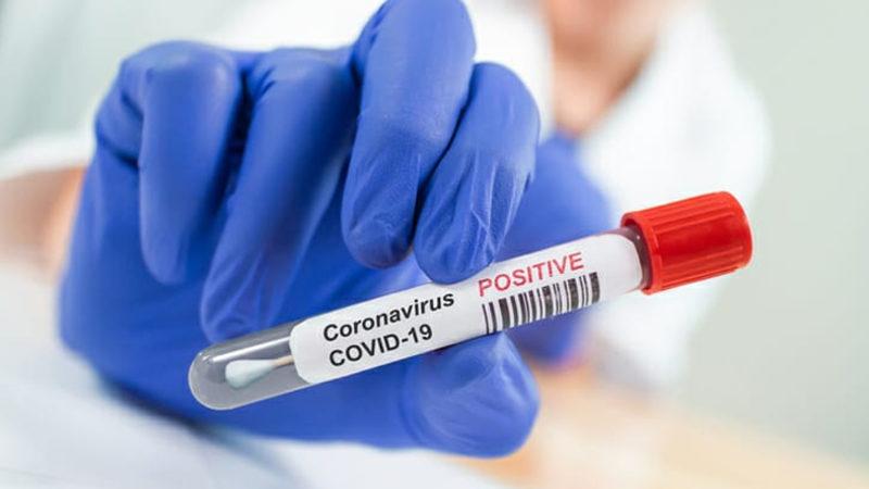 Türk Öğrenci, Türkiye’deki Günlük Vaka Sayısını Tahmin Eden Algoritma Geliştirdi