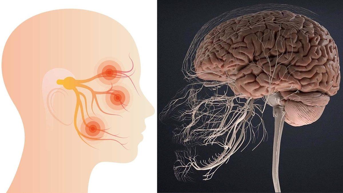 Yaşattığı Şiddetli Ağrı Yüzünden İnsanları Delirtip İntihara Sürükleyen Korkunç Hastalık: Trigeminal Nevralji