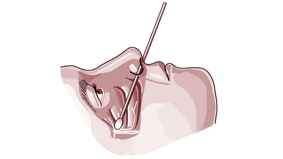 Yaşattığı Şiddetli Ağrı Yüzünden İnsanları Delirtip İntihara Sürükleyen Korkunç Hastalık: Trigeminal Nevralji