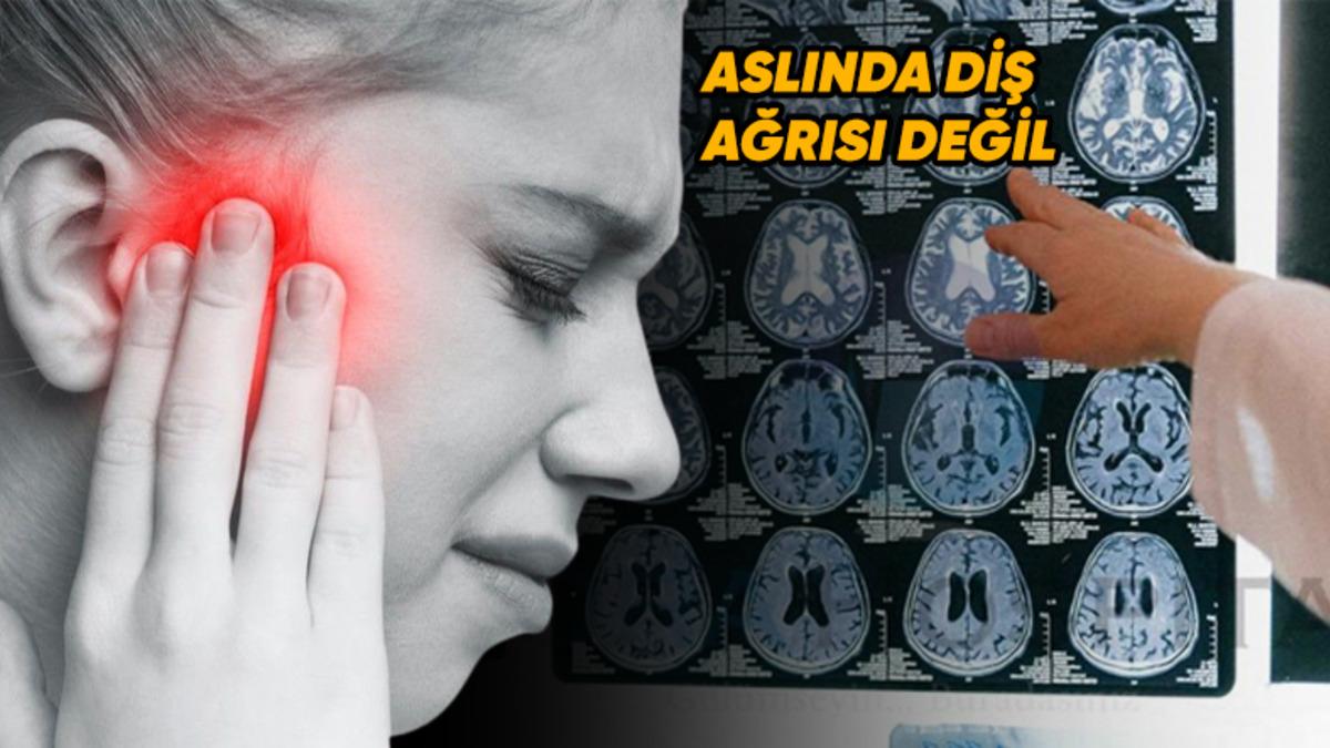 Yaşattığı Şiddetli Ağrı Yüzünden İnsanları Delirtip İntihara Sürükleyen Korkunç Hastalık: Trigeminal Nevralji