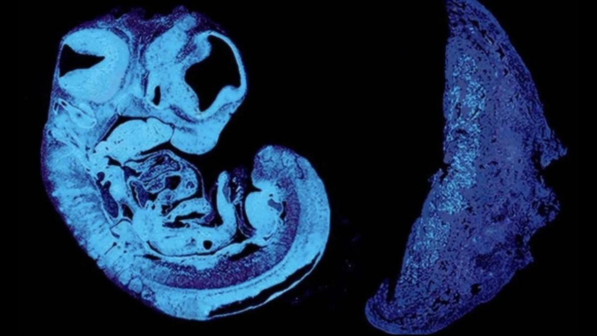 Anne ve Babanın Bebeği Beslemek İçin Daha Anne Karnındayken Kavgaya Başladığı Keşfedildi