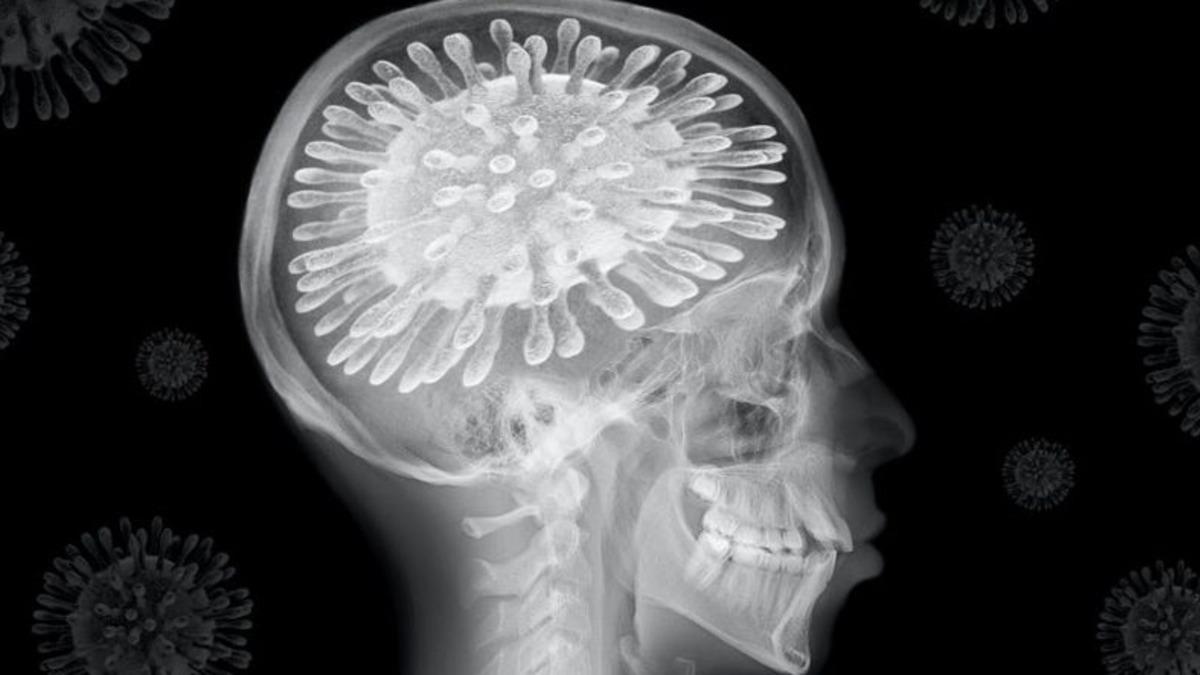 Koronavirüsü Ağır Atlatan Kişilerin IQ Seviyelerinin Düştüğü Tespit Edildi