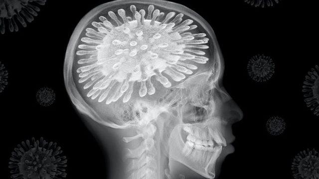 Koronavirüsü Ağır Atlatan Kişilerin IQ Seviyelerinin Düştüğü Tespit Edildi