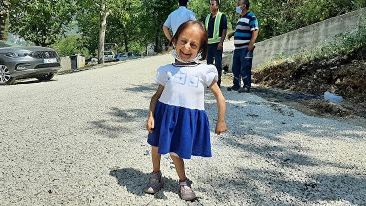 Dünyanın En Kısa Boylu Kadını Olarak Guinness Rekorlar Kitabına Giren Elif Kocaman Hayatını Kaybetti