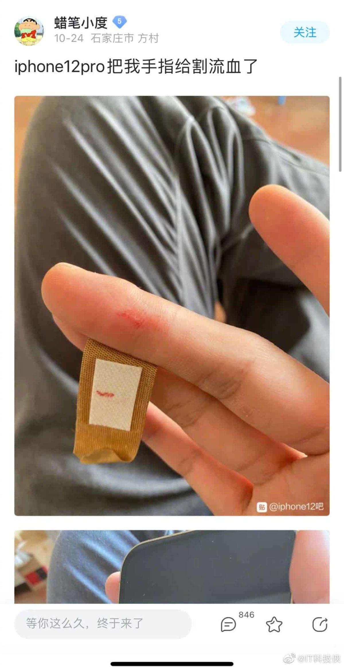 iPhone 12 Kullanıcıları, Çerçevelerin Çok Keskin Olduğunu ve Elde Yara Yaptığını Söylüyor