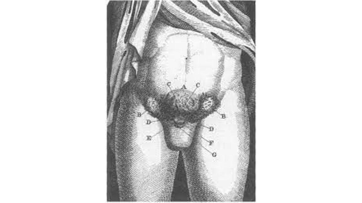 Doğuştan Hem Kadın Hem Erkek Olma Durumu ’Hermafroditizm’ Nedir, Nasıl Tedavi Ediliyor?