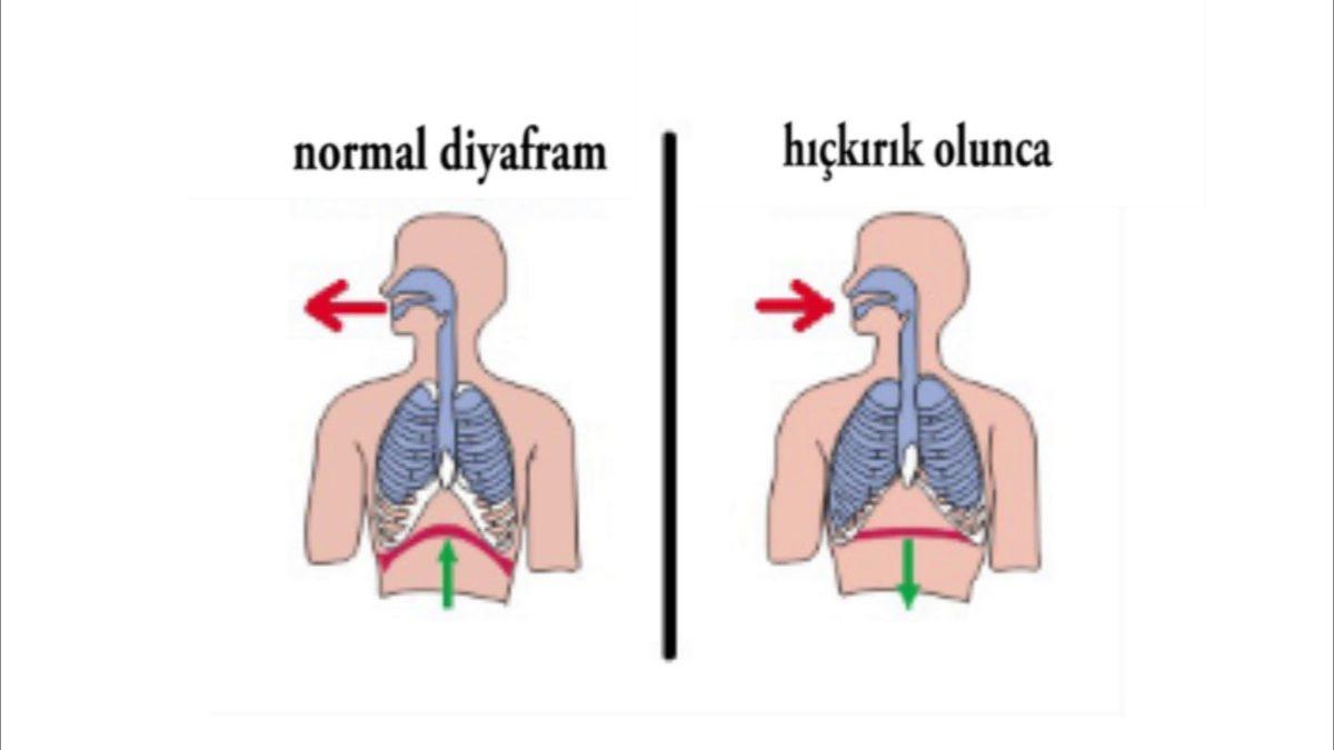 Bir Başladığında Durmak Bilmeyen Hıçkırığın Sebepleri Nedir, Nasıl Geçer?