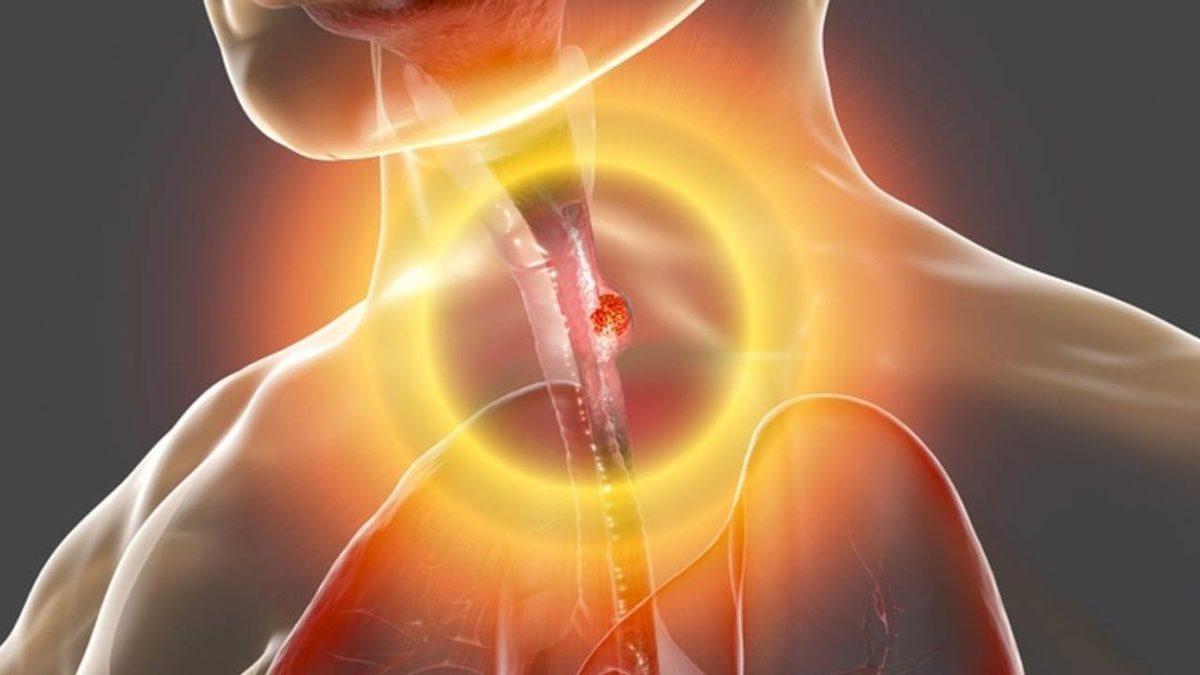 Bir Başladığında Durmak Bilmeyen Hıçkırığın Sebepleri Nedir, Nasıl Geçer?