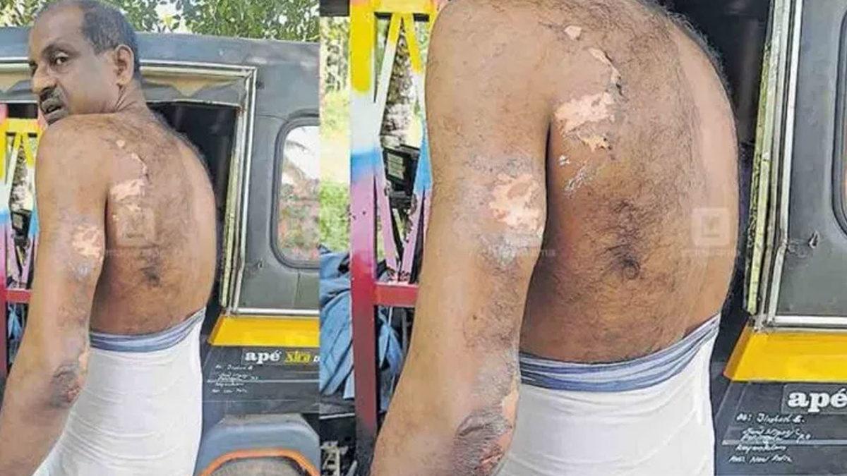 Bir Adamın Uyurken Yastığının Altına Koyduğu Nokia Telefon Alev Aldı