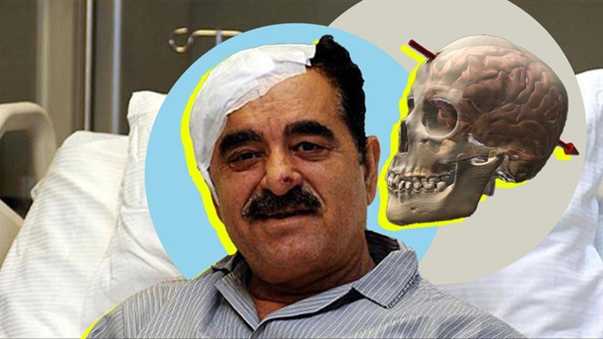 Bazı İnsanlar, Tam Kafalarından Vurulsalar Bile Nasıl Hayatta Kalıyorlar?