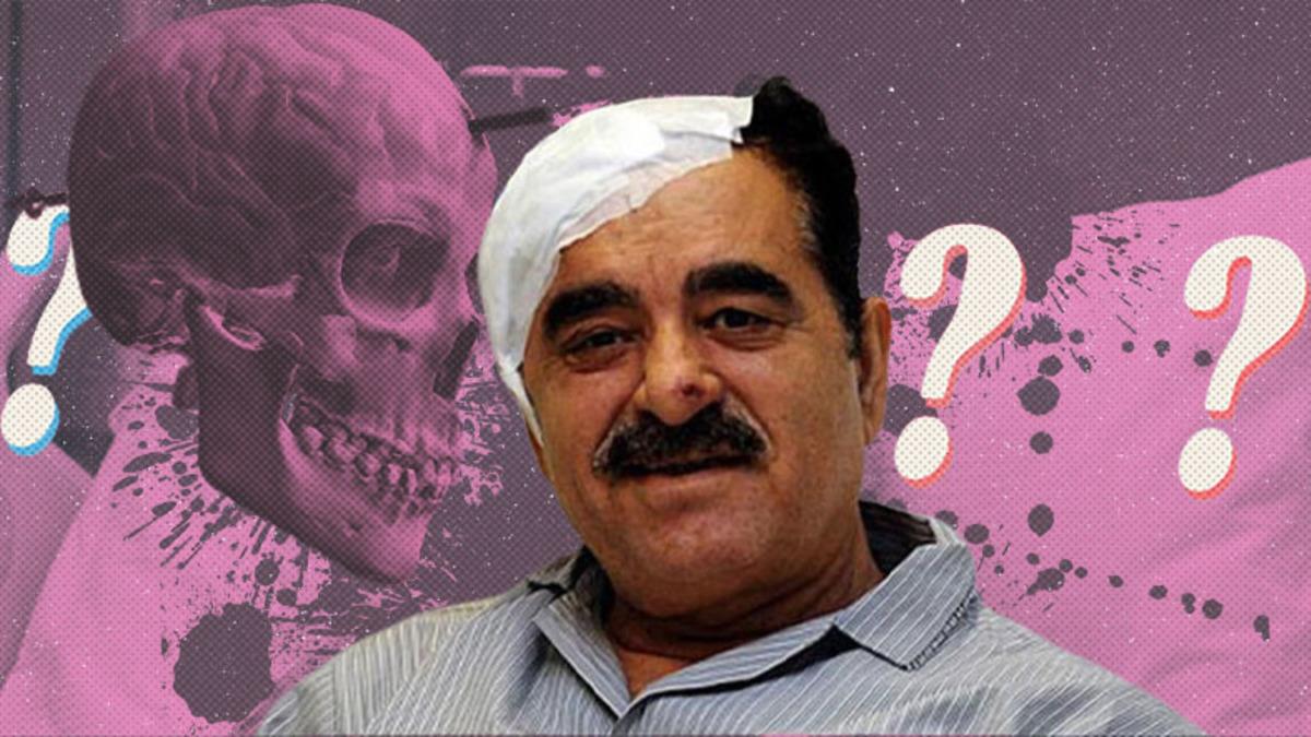 Bazı İnsanlar, Tam Kafalarından Vurulsalar Bile Nasıl Hayatta Kalıyorlar?