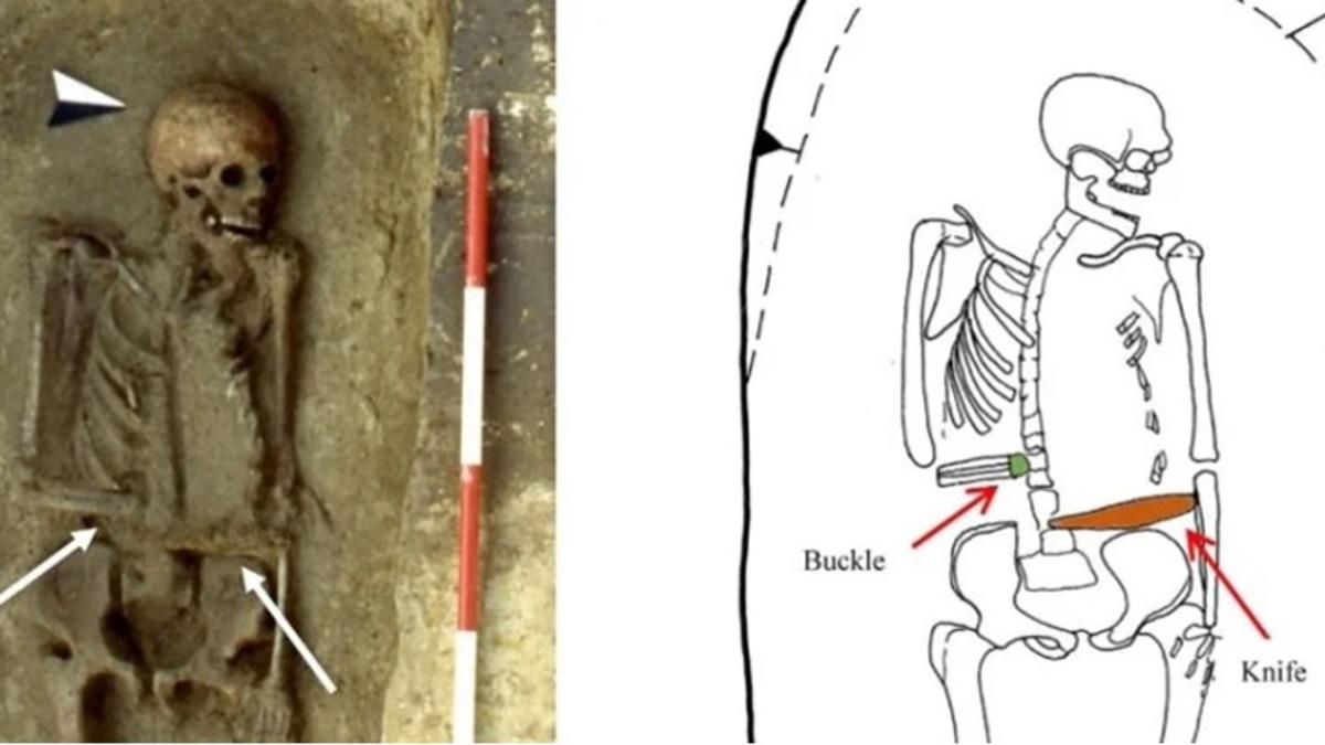 Orta Çağ’da Yaşayan Bir Savaşçının, Kopan Eli Yerine Yerleştirdiği Bir Bıçakla Uzun Süre Yaşadığı Keşfedildi