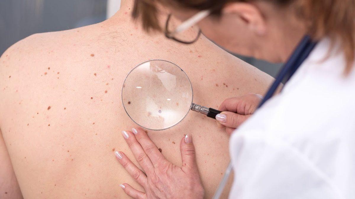 Güneş’in Zararlı Etkisi Olan UV İndeksi Nedir, Buna Maruz Kalmamak İçin Ne Yapmalıyız?