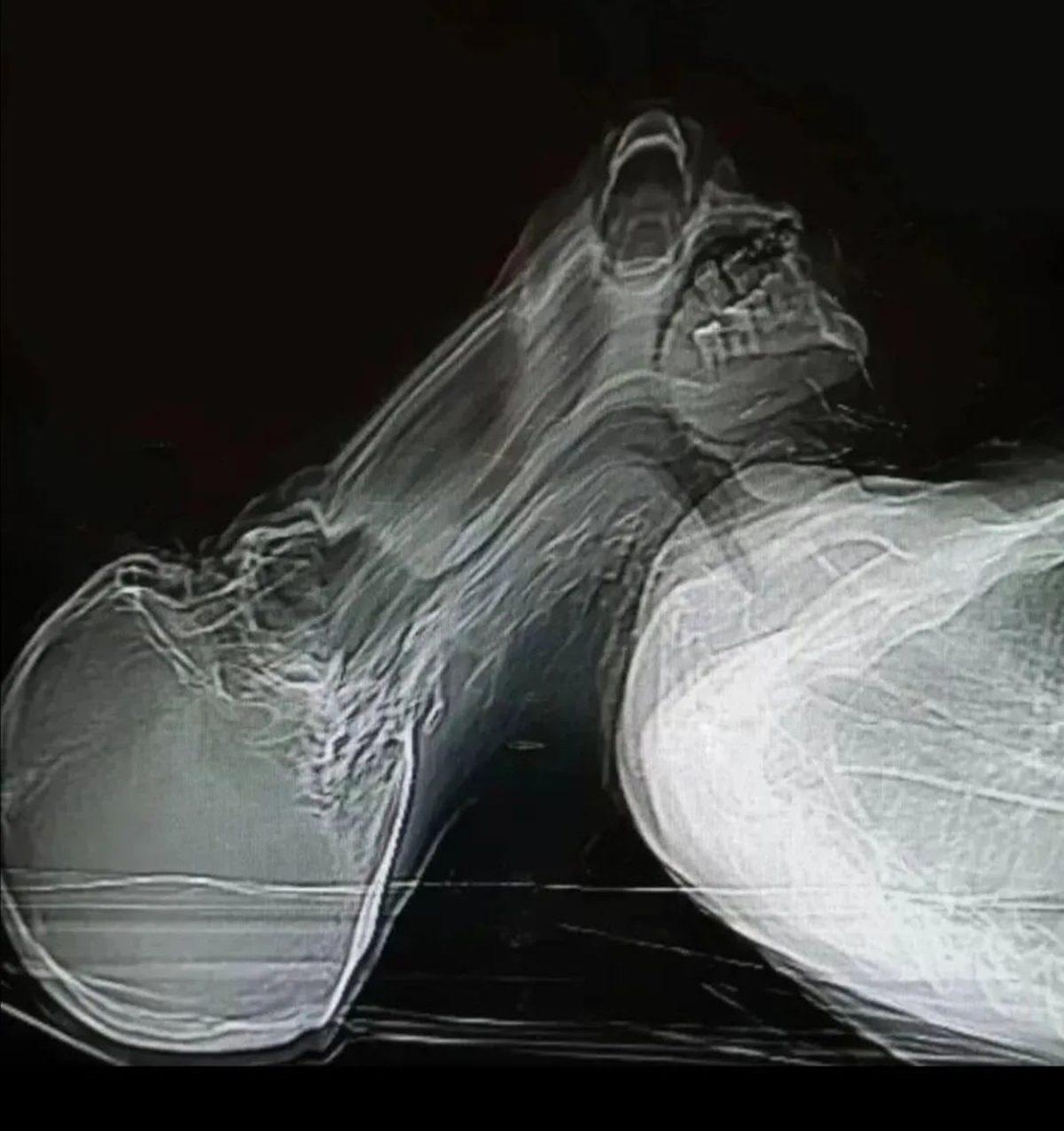 Gerçek Olduğuna İnanmakta Güçlük Çekeceğiniz 25 Sıra Dışı Görüntü