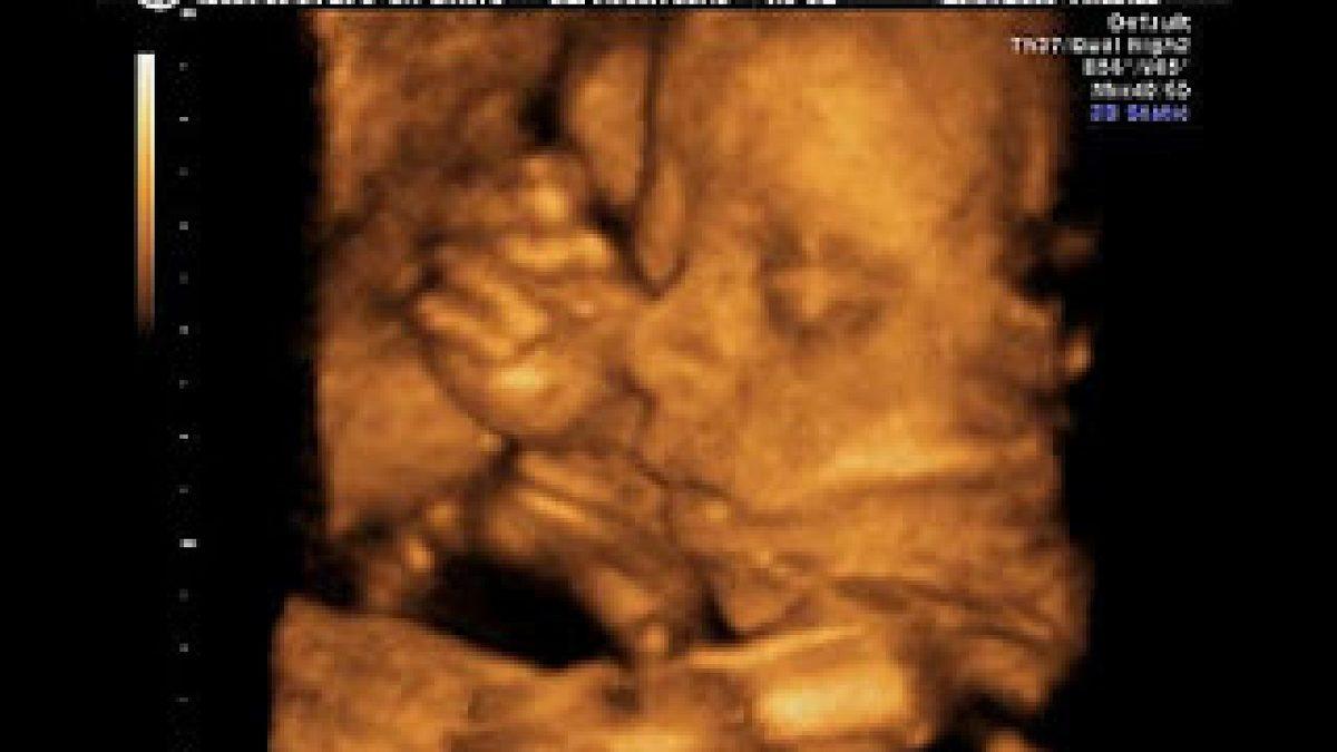 Ultrason Nedir, Nasıl Çalışır, Çeşitleri Nedir?