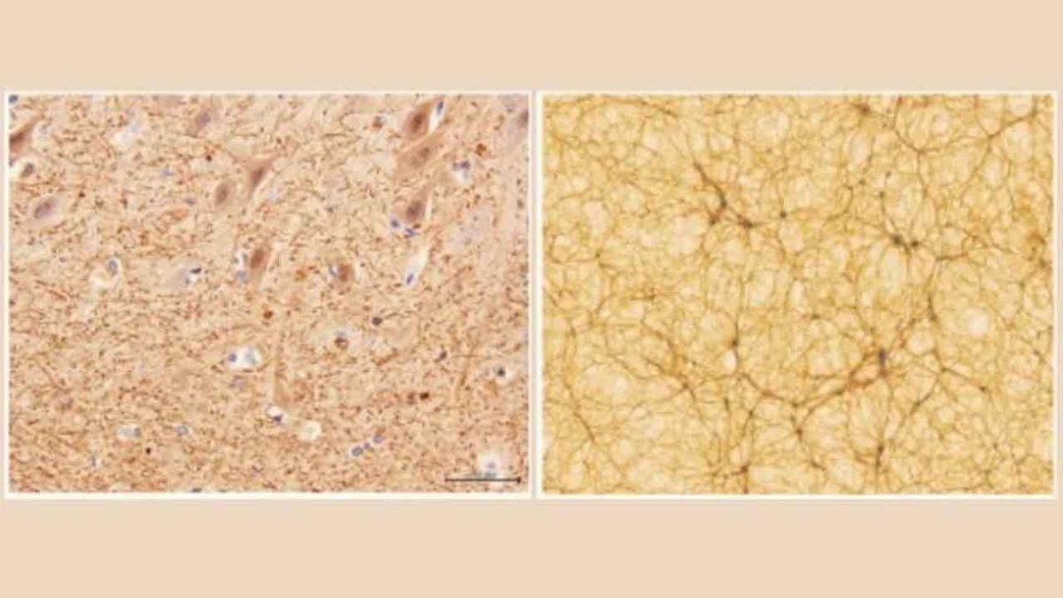 İnsan Beyni ile Evrenin Haritasının Birbiriyle Olan Ürkütücü Boyuttaki Benzerliği