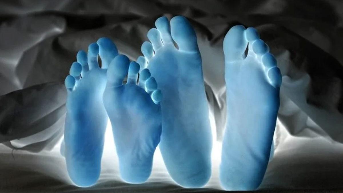 Bazı İnsanların Seks Sırasında ve Sonrasında Neden Hayatını Kaybettiği Açıklandı