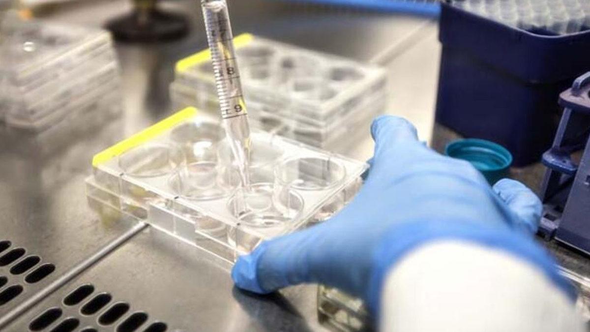 COVID-19’a Göre Onlarca Kat Daha Ölümcül Yeni Salgın Kapıda: NeoCoV Virüsü Hakkındaki İlk Araştırmanın Sonuçları Açıklandı