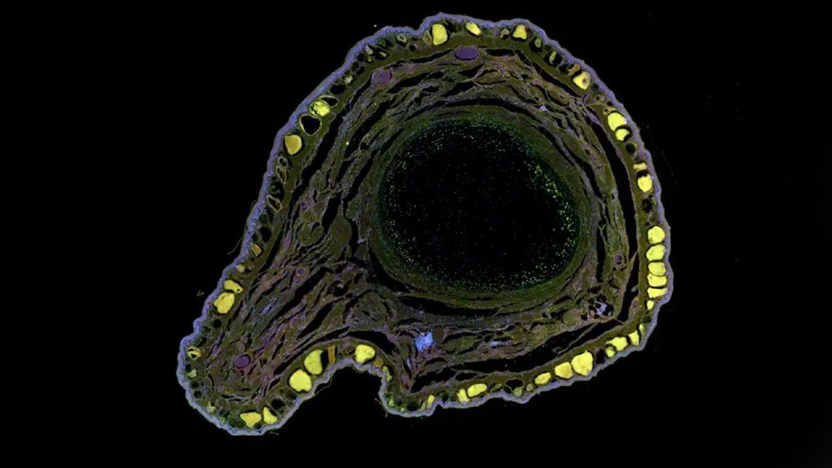 Kurbağaların Eksik Uzuvlarının Yeniden Büyümesini Sağlayan Bir İlaç Geliştirildi: İnsanlar İçin Geliştirilecek Tedavilere Öncülük Edebilir