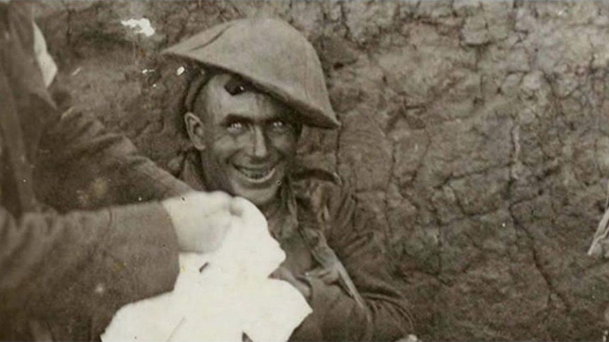 Cephedeki Askerleri Delirterek Anlamsız Mimikler Yapmalarına Neden Olan Korkunç Hastalık: Shell Shock