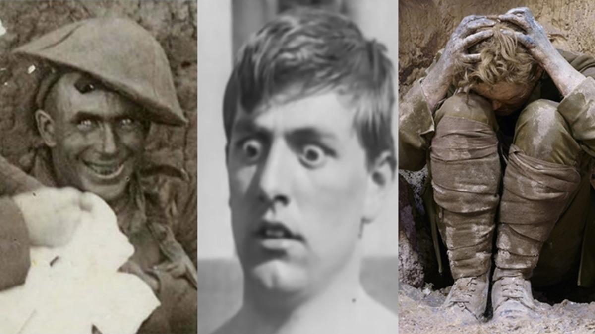 Cephedeki Askerleri Delirterek Anlamsız Mimikler Yapmalarına Neden Olan Korkunç Hastalık: Shell Shock