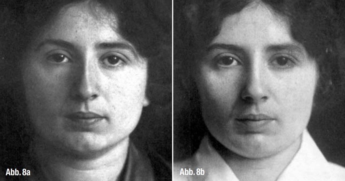 Çanakkale Savaşı’nda Yüzü Parçalanan Türk Asker ile Ona Yüz Estetiği Yapan Alman Doktorun Çarpıcı Hikâyesi