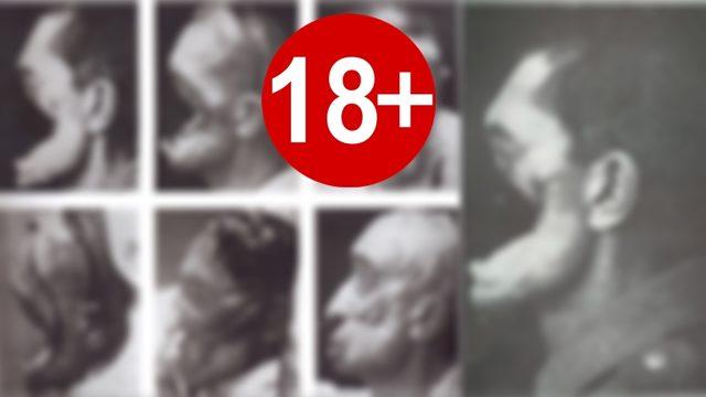 Çanakkale Savaşı’nda Yüzü Parçalanan Türk Asker ile Ona Yüz Estetiği Yapan Alman Doktorun Çarpıcı Hikâyesi